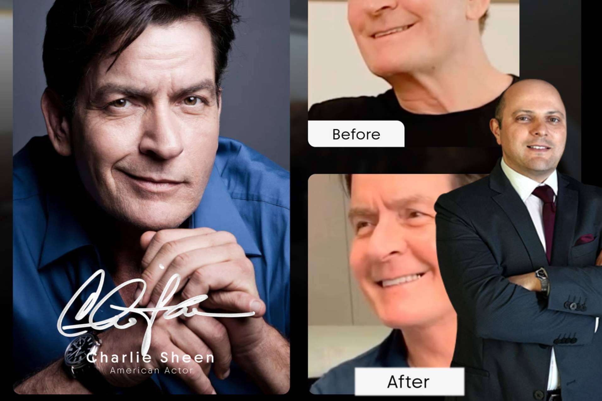 From Hollywood to Miami; Elite Plastic Surgery Is Now Closer Than Ever